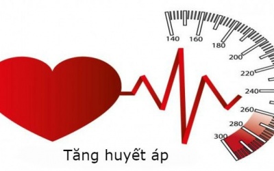 Không uống thuốc, chỉ giảm cân liệu có giảm được cholesterol và huyết áp? 