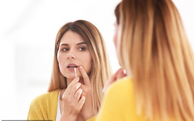 Mụn rộp trên môi và mũi do đâu? 