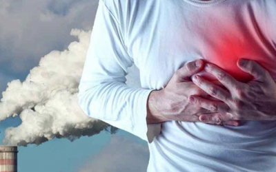 Ô nhiễm không khí có thể làm tăng nguy cơ xơ vữa động mạch