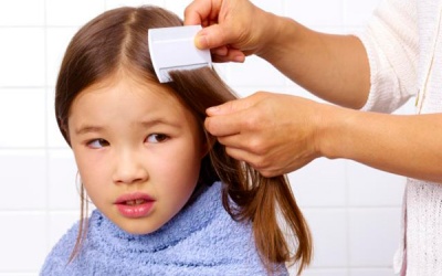 15 biện pháp trị chấy nhanh chóng, không cần hóa chất