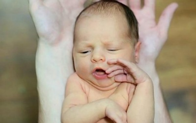 Bé bị vàng da: Mẹ nên làm gì?