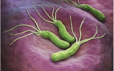 Cảnh báo cách thức lây lan của vi khuẩn Hp gây bệnh dạ dày