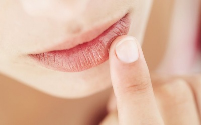 Đôi môi nứt nẻ, khô ráp: Áp dụng ngay 4 biện pháp này
