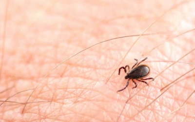 Dấu hiệu cảnh báo nguy hiểm khi nhiễm trùng do bọ ve đốt (bệnh Lyme) 