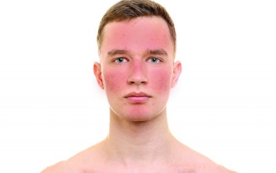 Tập thể dục có thực sự tốt cho làn da?