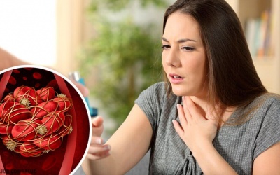 Cảnh giác với 8 dấu hiệu cảnh báo cục máu đông