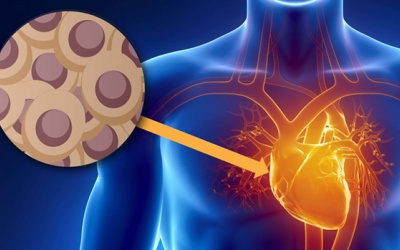 Điều trị suy tim bằng tế bào gốc: Tái tạo thành công mô tim tổn thương  