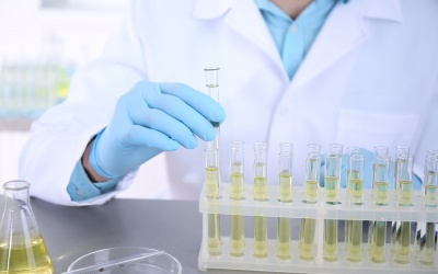 Đường huyết cao nhưng nước tiểu không có đường, liệu đã mắc đái tháo đường chưa?