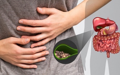 Phẫu thuật 3 lần vẫn còn sỏi mật, làm cách nào để loại bỏ hết sỏi?