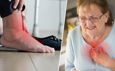 Suy tim gây mệt mỏi, phù chân: Làm sao để cải thiện triệu chứng?