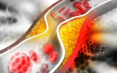 Bệnh động mạch vành có nguy hiểm không, có thể gây biến chứng gì?