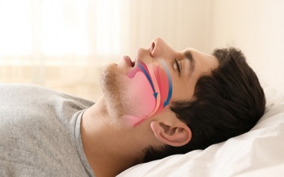 5 cách khắc phục chứng ngưng thở khi ngủ để có giấc ngủ ngon