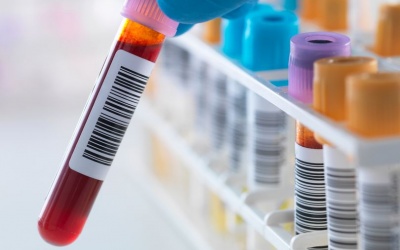 Khó tin: Xét nghiệm máu mới giúp dự đoán được khi nào bạn sẽ chết?