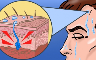 9 nguyên nhân không ngờ khiến bạn đổ mồ hôi nhiều