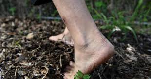 Căn bệnh do 'vi khuẩn ăn thịt người' gây ra nguy hiểm như thế nào?