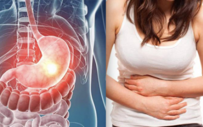 Nguyên nhân và dấu hiệu dạ dày chứa vi khuẩn HP dễ gây ung thư