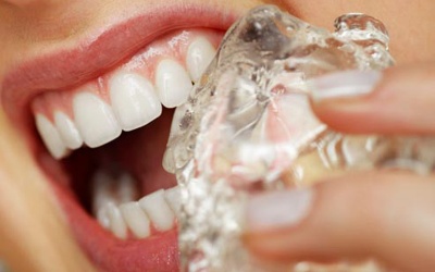 5 thói quen có thể làm hỏng răng của bạn