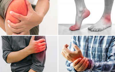 Cách phân biệt viêm khớp dạng thấp và hội chứng ống cổ tay