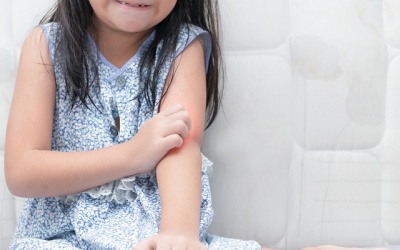 Dùng kem Eczestop cho trẻ 2 tuổi có an toàn?