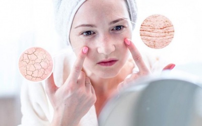 Da khô và da mất nước: Phân biệt đúng để khắc phục nhanh