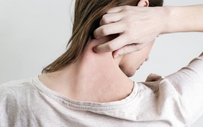 Dùng TPCN Kim Miễn Khang có cải thiện được vẩy nến không?