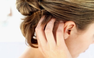 Nên làm gì để giảm ngứa da đầu?