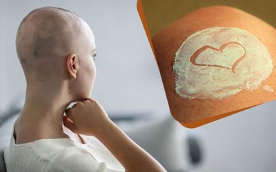 Làm sao khắc phục tình trạng da khô do hóa trị ung thư?