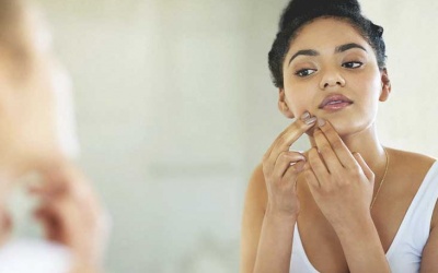 Những cách đơn giản giúp loại bỏ mụn trứng cá ở cằm