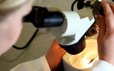 Công nghệ mới giúp lý giải sự hình thành khối u ung thư đại tràng từ giai đoạn sớm nhất