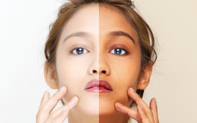 Cảnh báo nhiễm độc thủy ngân do dùng kem làm trắng da 'thần tốc'