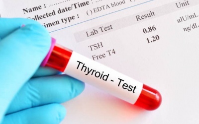 Kết quả xét nghiệm máu chỉ số TSH là 1.264 nghĩa là sao?