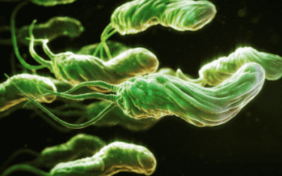 HP dương tính và nỗi ám ảnh của những người bị đau dạ dày