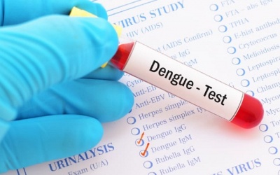 Nên làm xét nghiệm nào để phát hiện sớm sốt xuất huyết?