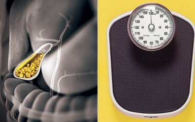 Ăn kiêng có khiến bệnh sỏi mật thêm nghiêm trọng?