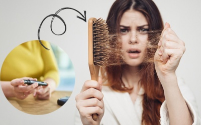 Đái tháo đường gây rụng tóc, phải làm gì để khắc phục?