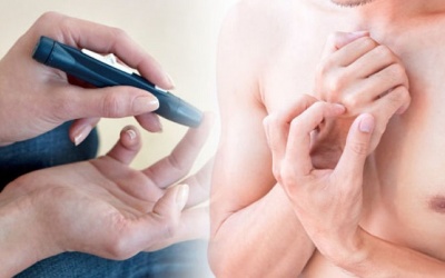 Tại sao người bệnh đái tháo đường hay bị ngứa da?