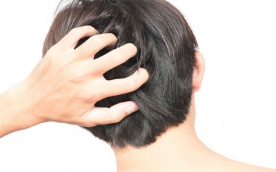 Đừng để vẩy nến da đầu ảnh hưởng đến cuộc sống của bạn