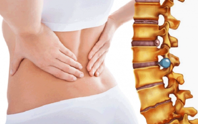 Những dấu hiệu cảnh báo bạn đang bị thoát vị đĩa đệm
