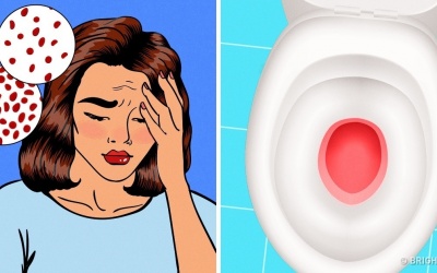 Những dấu hiệu điển hình 'tố cáo' cơ thể bạn đang bị thiếu sắt