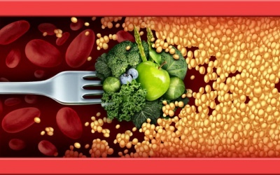 Chế độ ăn uống ảnh hưởng thế nào tới bệnh động mạch vành?