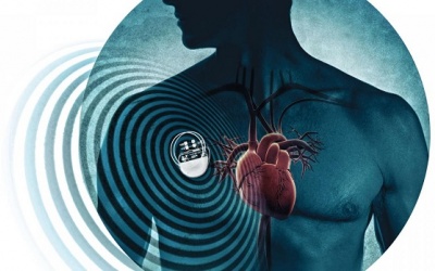 Những lưu ý để có thể chung sống với máy tạo nhịp tim