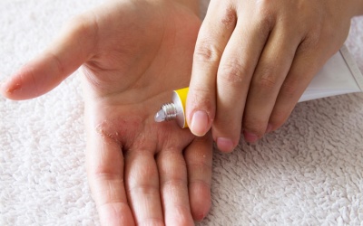 6 dấu hiệu cho thấy bạn cần thay đổi phương pháp điều trị vẩy nến