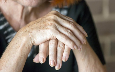 Viêm khớp dạng thấp không điều trị nguy hiểm thế nào?