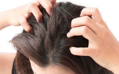 4 biện pháp tự nhiên trị ngứa da đầu hiệu quả tại nhà