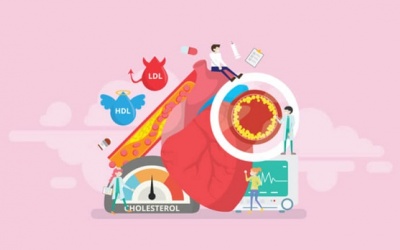Những cách đơn giản để giảm cholesterol trong máu, phòng ngừa suy tim 