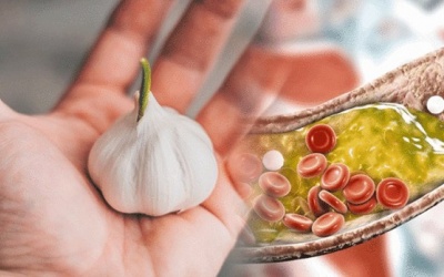 Các loại thảo dược giúp khắc phục tình trạng mỡ máu cao