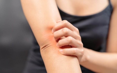 Bị vảy nến nên điều trị thế nào? Ở đâu?