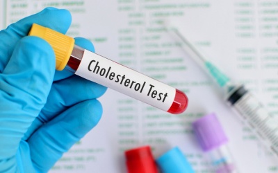 4 khám phá mới giúp bạn hiểu hơn về cholesterol