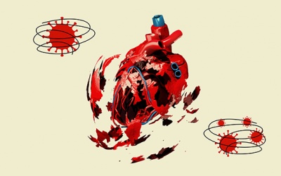 Bệnh lý Covid-19 nghiêm trọng có thể gây tổn thương trái tim