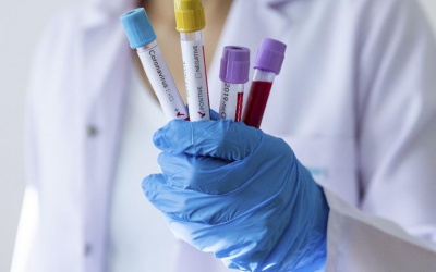 Người có nhóm máu nào có nguy cơ nhiễm SARS-CoV-2 cao hơn?